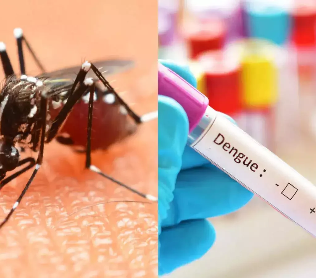 UP में डेंगू के 5 हजार मरीज़..बिना बुखार कम हो रहे प्लेटलेट्स