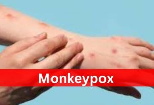 Monkey Pox